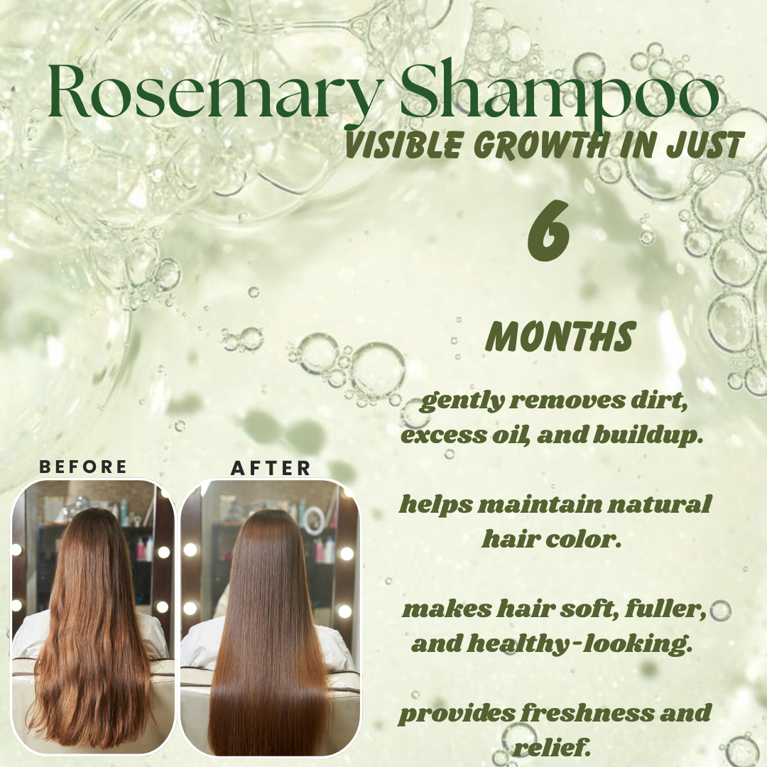 Rosemary Anti-hairfall shampoo
